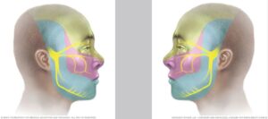 Trigeminalna neuralgija i Cranial Facial Release (CFR)