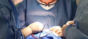 Razlike između cranial facial release (CFR) i operacija nosa